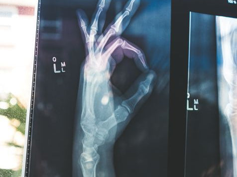 Calcium Supplements: Compare Quality