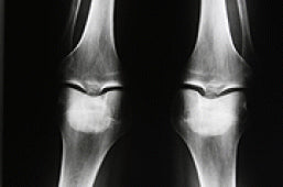 Top 10 Health Stories of 2009