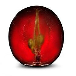 Gut Inflammation Can Adversely Alter Your Brain